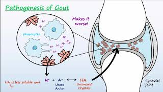 Gout  Mechanisms amp Treatment [upl. by Yellehs]