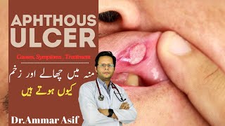 Why You Keep Getting Mouth Sores Aphthous Ulcers [upl. by Aland287]