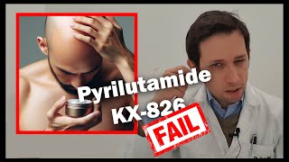 Pyrilutamide KX826 probable FRACASO ¿Funcionarán el resto de tratamientos para la alopecia [upl. by Ahtan235]