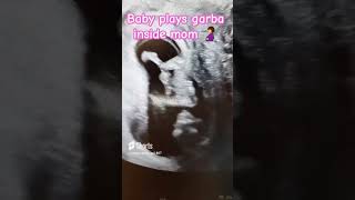 BABY IN DANCE MODE  26 WEEK ULTRASOUND 🤗 pregnancyjourney [upl. by Akilat]