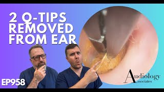 2 QTIPS REMOVED FROM EAR  EP958 [upl. by Ashlie]