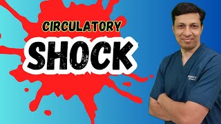 Shock and its types in hindi  Circulatory shock  shock in hindi Shock physiology [upl. by Cindy]