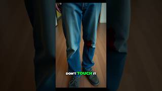 The Shocking Injury That Changed Everything shorts youtubeshorts trending viral [upl. by Siberson]