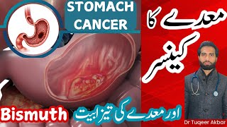 Cancer of Stomach Stomach diseases Bismuth Stomach Pain Acidity Vomiting UrduampHindi Dr Tuqeer [upl. by Lowndes]