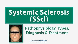 Systemic Sclerosis SScl  Scleroderma  Types Pathophysiology Diagnosis amp Treatment of SScl [upl. by Nitsyrc]