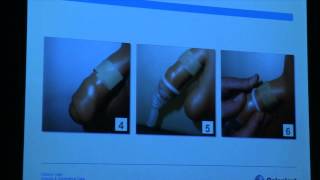 Symposium urologie prostaatkanker 6 december 2014  Anne Neirynck [upl. by Ecargyram]