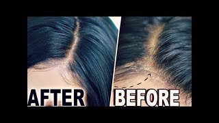 How To quotHIDE LACEquot amp Wig Cap Lace Wigs Fake Scalp Method  ORIGINAL CREATOR [upl. by Lancaster]