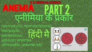 Anemia amp its types simple एक्सप्लनेशन हिंदी ANEMIA PART 2 [upl. by Aihsiym]