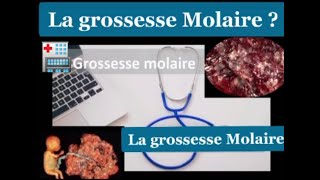 Tableau Médical 06  La Grossesse Molaire [upl. by Enived]