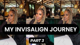 INVISALIGN JOURNEY PART 4  FINISHED SHAVING TEETH DOWN [upl. by Pyle]