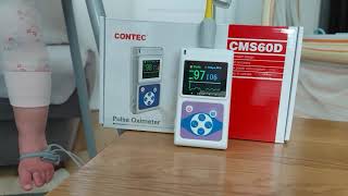 Pulsoksymetr Contec CMS 60d [upl. by Dlareg]