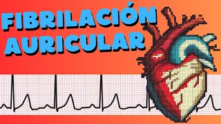 ¿Qué es la fibrilación auricular [upl. by Hicks140]