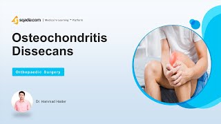 Osteochondritis Dissicens  Introduction  Orthopedic Surgery Lecture  VLearning™ [upl. by Mattox]