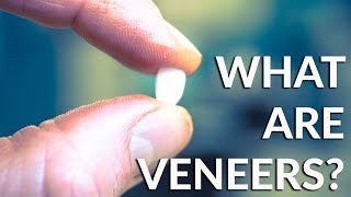 DENTAL VENEERS  WHAT THE HECK ARE THEY COSMETIC DENTISTRY [upl. by Grimaldi]