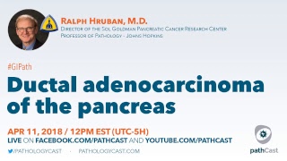 Ductal adenocarcinoma of the pancreas  Dr Hruban Hopkins GIPATH [upl. by Subocaj774]