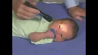 Neurological Examination of Newborn [upl. by Hyams]