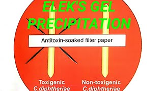 Eleks gel precipitation test in hindi [upl. by Dj]