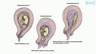 prostaglandin E2 English  Medical terminology for medical students [upl. by Ojeillib]