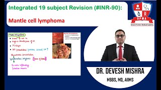 🕉 Integrated 19 subject Revision INR90 Mantle cell lymphoma by Dr Devesh Mishra [upl. by Carl]