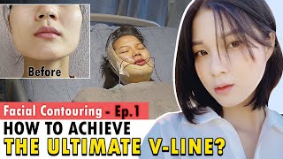 SUB Ultimate VLine Face  Facial Bone Contouring Surgery in Korea  Cheekbone amp Jawline Reduction [upl. by Leiva503]