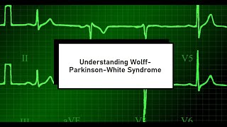 Understanding WolffParkinsonWhite Syndrome ECG [upl. by Vashtia]