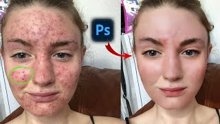 HOW to SMOOTH SKIN using FREQUENCY SEPARATION in Photoshop  Skin Retouching Tutorial [upl. by Janie444]