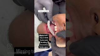 This is Insane  Snapon Smile looks so real when veneers and dental implants are too pricey [upl. by Artemed]