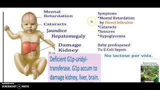 What causes galactosemia  Symptoms Types Genetic Testing Treatment Diet Safe food USMLE NCLEX 3 Mn [upl. by Iroj46]