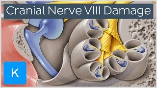 What happens when the vestibulocochlear nerve is damaged  Human Anatomy  Kenhub [upl. by Hescock]