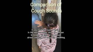 If you hear this kind of cough sound first have them breathe in cold airㅣCroup cough sound [upl. by Ledeen]