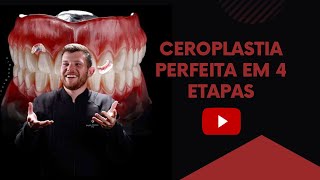 Ceroplastia Perfeita  Magno Sanches [upl. by Yanej]