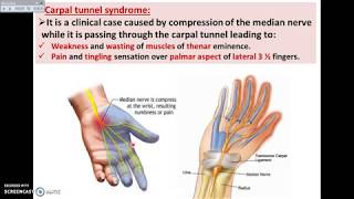 Overview of UL 14  Deep Fascia of Palm of the Hand  Dr Ahmed Farid [upl. by Emerson]