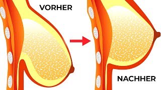 5 effektive Möglichkeiten für einen schönen Busen und ein straffes Dekollete [upl. by Storz]