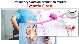 What is Cystatin c test [upl. by Cate]