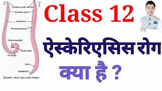 ascariasis disease class 12 ऐस्कैरिएसिस रोग vedio 100 [upl. by Donn948]