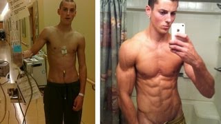 Body TransformationCancer to Bodybuilder [upl. by Kinelski]