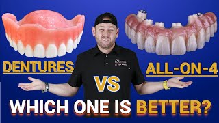 Dentures vs Snap in Dentures vs ALL on 4 ®️ Bridge [upl. by Ihp]