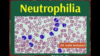 Neutrophilia and Neutropenia Causes amp Evaluation [upl. by Marlea]