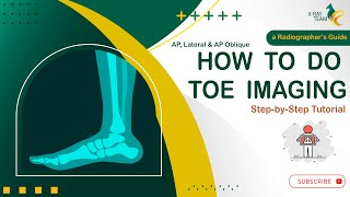 Essential Radiographic Techniques for Imaging Toes AP AP Oblique and Lateral Views [upl. by Ardnalac]