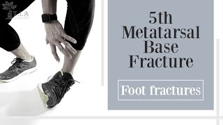 5th Metatarsal Base Fracture  foot fracture [upl. by Annaeed]