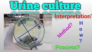 Urine culture test procedure Microbiology [upl. by Kemme337]