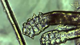 Demodex mites [upl. by Pelagia]