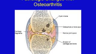 Musculoskeletal Disorders [upl. by Anada]