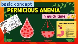 Pernicious anemia  what is anemia  cause  symptoms  treatment [upl. by Valera]