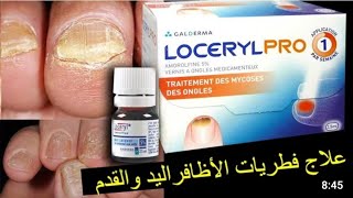 علاج فطريات الاظافر loceryl [upl. by Lashondra]