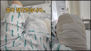 병원 Vlog 굿바이 오른다리 [upl. by Ariadne]