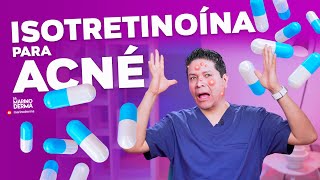 ISOTRETINOÍNA PARA ACNÉ  DERMATÓLOGO OPINA [upl. by Nydia]