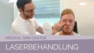 Laserbehandlung im Medical Skin Center – Dr Bacman [upl. by Comras]