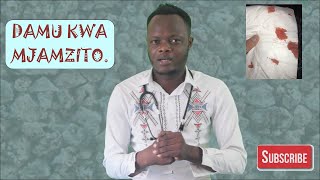 Kwanini mama mjamzito hutoktwa na matone ya damu Kutokwa damu kwa mama mjamzito [upl. by Dekeles425]