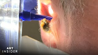 Water Device Painlessly Removes Earwax  Art Insider [upl. by Sokairyk]